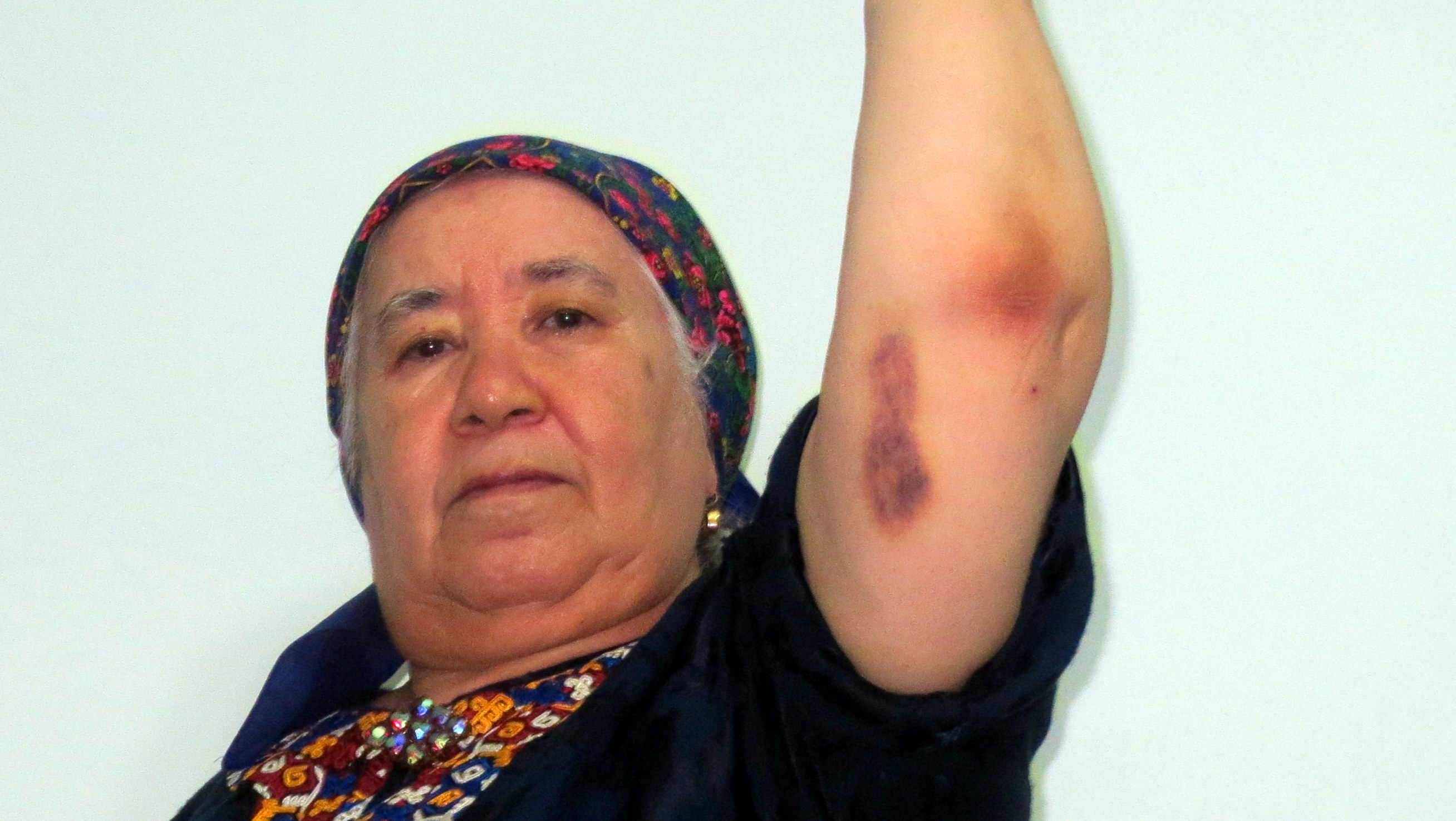 Journalist suffers repeat attack in Turkmenistan